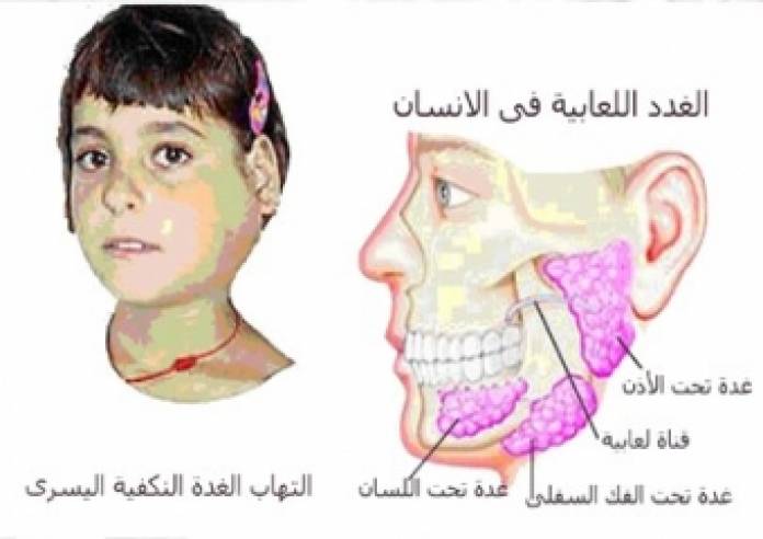 تقرير :  الصحة تؤكد تسجيل 47 حالة تعاني من مرض النكاف بمحافظة خان يونس